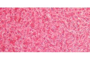 Immunohistochemistry of paraffin-embedded Human Liver using Cathepsin B Polyclonal Antibody at dilution of 1:80.