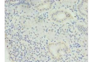 Immunohistochemistry of paraffin-embedded human pancreatic tissue using ABIN7159152 at dilution of 1:100 (MED27 anticorps  (AA 67-165))