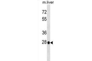 Western Blotting (WB) image for anti-Homeobox B5 (HOXB5) antibody (ABIN2999364) (HOXB5 anticorps)