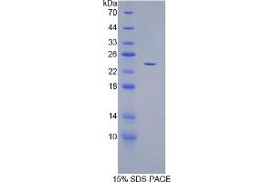 SDS-PAGE analysis of Human CDC25B Protein. (CDC25B Protéine)