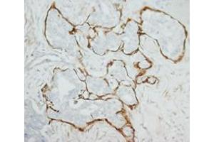 MMP2 Polyclonal Antibody (MMP2 anticorps  (C-Term))