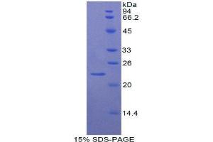 SDS-PAGE (SDS) image for Von Willebrand Factor (VWF) (AA 49-230) protein (His tag) (ABIN1081185) (VWF Protein (AA 49-230) (His tag))