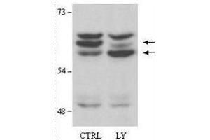 Western Blot of Rabbit anti-AKT2 antibody.