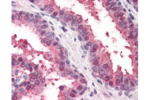 Anti-RAD23B antibody IHC of human prostate. (RAD23B anticorps  (AA 163-176))