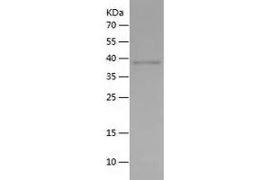 Western Blotting (WB) image for Sirtuin 1 (SIRT1) (AA 510-747) protein (His tag) (ABIN7125104)