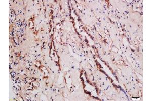 Formalin-fixed and paraffin embedded human kidney labeled with Rabbit Anti-TNFSF15 Polyclonal Antibody, Unconjugated  at 1:200 followed by conjugation to the secondary antibody and DAB staining