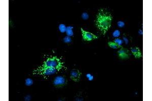 Image no. 3 for anti-Ubiquinol-Cytochrome C Reductase Core Protein I (UQCRC1) (AA 46-305) antibody (ABIN1491532)