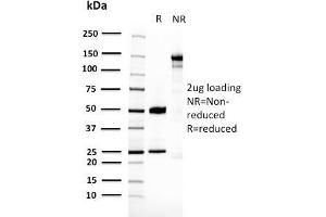 SDS-PAGE Analysis Purified 14-3-3E Mouse Monoclonal Antibody (CPTC-YWHAE-1).