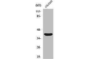 Western Blot analysis of COLO205 cells using Siah-2 Polyclonal Antibody (SIAH2 anticorps  (C-Term))