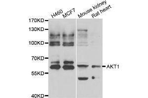 Western blot analysis of extracts of various cell lines, using AKT1 antibody (ABIN5974372). (AKT1 anticorps)