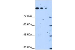Western Blot showing SETD2 antibody used at a concentration of 1.