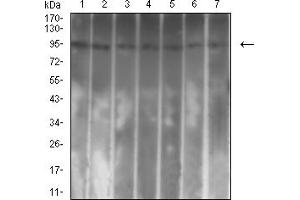 Western blot analysis using CD131 mouse mAb against NIH/3T3 (1), Hela (2), C6 (3), HL-60 (4), Jurkat (5), MCF-7 (6), and PC-12 (7) cell lysate.