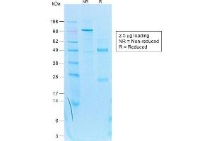 SDS-PAGE Analysis Purified Cytokeratin 7 Rabbit Recombinant Monoclonal Antibody (KRT7/1499R).