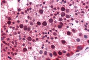 Human Testis: Formalin-Fixed, Paraffin-Embedded (FFPE)