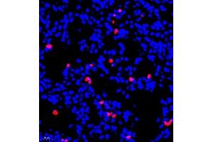 Immunofluorescent analysis of paraffin embedded mouse lung using S100A9 (ABIN7075497) at dilution of 1: 900 (S100A9 anticorps)