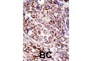 anti-Ubiquitin Specific Peptidase 3 (USP3) (AA 489-519), (C-Term) antibody