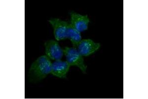 ICC/IF analysis of AKR1C1 in A431 cells line, stained with DAPI (Blue) for nucleus staining and monoclonal anti-human AKR1C1 antibody (1:100) with goat anti-mouse IgG-Alexa fluor 488 conjugate (Green).