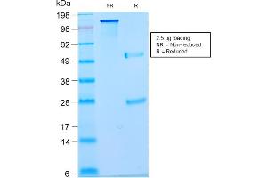 SDS-PAGE Analysis Purified Pan-Nuclear Antigen Monoclonal Antibody (NM2984R). (Recombinant Nuclear Antigen (Pan-Nuclear Marker) anticorps)