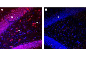 Expression of Pannexin 1 in rat hippocampus.