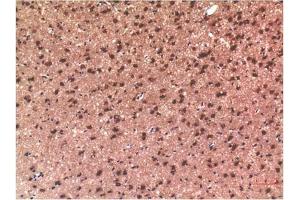 Immunohistochemical analysis of paraffin-embedded Rat Brain Tissue using Tau Mouse mAb diluted at 1:200.