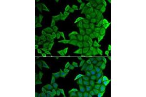 Immunofluorescence analysis of U2OS cells using SMYD2 Polyclonal Antibody (SMYD2A anticorps)