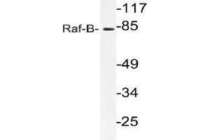 Western blot (WB) analysis of Raf-B antibody in extracts from 293 cells. (BRAF anticorps)