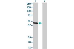 Western Blot analysis of CPA2 expression in transfected 293T cell line by CPA2 monoclonal antibody (M02), clone 2E11.