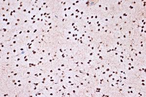 Immunohistochemistry of paraffin-embedded rat brain using KHSRP Rabbit mAb (ABIN7268110) at dilution of 1:100 (40x lens).