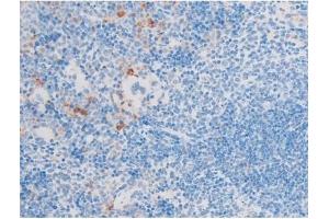 ABIN6255701 and ABIN6267554 at 1/200 staining Mouse spleen tissue sections by IHC-P. (LIM Domain Kinase 1 anticorps  (pThr508))
