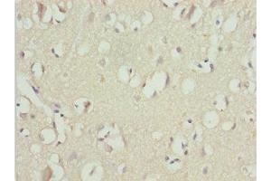 Immunohistochemistry of paraffin-embedded human brain tissue using ABIN7174528 at dilution of 1:100 (UBA6 anticorps  (AA 1-260))
