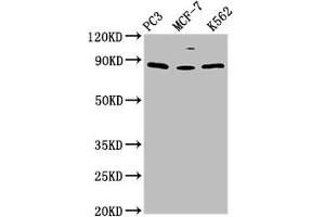 Western Blot Positive WB detected in: PC-3 whole cell lysate, MCF-7 whole cell lysate, K562 whole cell lysate All lanes: TRIM28 antibody at 1.