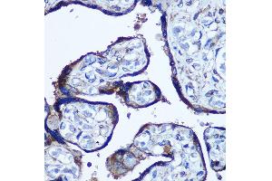 Immunohistochemistry of paraffin-embedded Human placenta using TBCCD1 Rabbit pAb (ABIN7270751) at dilution of 1:100 (40x lens). (TBCCD1 anticorps)