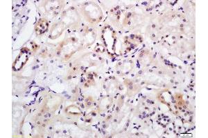 Formalin-fixed and paraffin embedded human kidney labeled with Anti-WNT7A Polyclonal Antibody, Unconjugated (ABIN719336) at 1:200 followed by conjugation to the secondary antibody and DAB staining