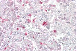 anti-5-Methyltetrahydrofolate-Homocysteine Methyltransferase (MTR) (C-Term) antibody