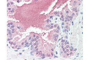 Anti-SLITRK6 antibody IHC of human prostate.