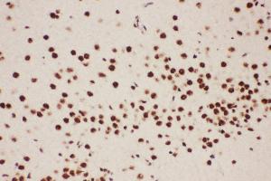 Anti-ALOX5 Picoband antibody,  IHC(P): Rat Brain Tissue (ALOX5 anticorps  (AA 120-483))