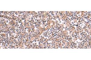 Immunohistochemistry of paraffin-embedded Human tonsil tissue using SLC12A7 Polyclonal Antibody at dilution of 1:50(x200) (SLC12A7 anticorps)