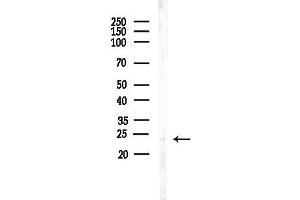 anti-Calcium and Integrin Binding Protein 4 (CIB4) (C-Term) antibody