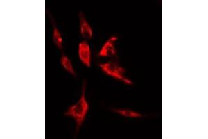 ABIN6274998 staining LOVO cells by IF/ICC. (CLN5 anticorps  (Internal Region))