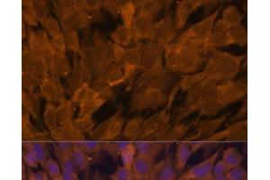 Immunofluorescence analysis of C6 cells using STAM2 Polyclonal Antibody at dilution of 1:100.