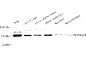 Western blot analysis of PCDHGC4 (ABIN7075310) at dilution of 1: 500 (PCDHGC4 anticorps)