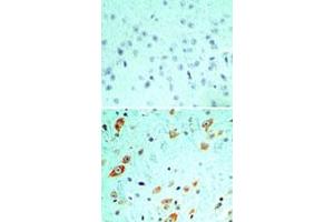 Immunohistochemical analysis of TLR5 in formalin-fixed, paraffin-embedded mouse brain tissue using an isotype control (top) and TLR5 monoclonal antibody, clone 19D759. (TLR5 anticorps  (AA 700-800))