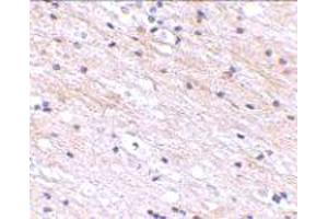 Immunohistochemical staining of human brain tissue with 2. (SATB1 anticorps  (N-Term))