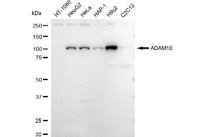Western blotting analysis using ADAM10 antibody (ABIN7797501).