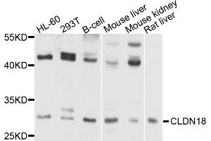 Western blot analysis of extract of various cells, using CLDN18 antibody. (Claudin 18 anticorps)