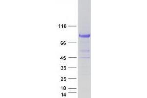 Macrophage Expressed Gene 1 (MPEG1) protein (Myc-DYKDDDDK Tag)