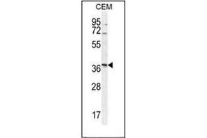 Western blot analysis of Neurexophilin-4 Antibody (C-term) in CEM cell line lysates (35ug/lane). (Neurexophilin 4 anticorps  (C-Term))