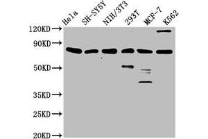 Western Blot Positive WB detected in: Hela whole cell lysate, SH-SY5Y whole cell lysate, NIH/3T3 whole cell lysate, 293T whole cell lysate, MCF-7 whole cell lysate, K562 whole cell lysate All lanes: KMT2E antibody at 3.