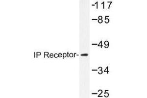 Image no. 1 for anti-Prostacyclin Receptor (PTGIR) antibody (ABIN317863) (Prostacyclin Receptor anticorps)