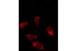 ABIN6278125 staining Hela by IF/ICC. (UNG anticorps  (Internal Region))